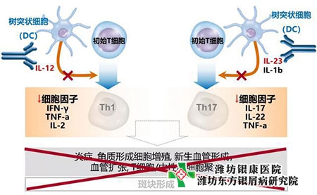 烏司奴單抗醫保最新價格