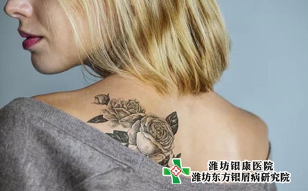 淮安銀屑病醫(yī)院看牛皮癬效果 淮安銀屑病醫(yī)院看牛皮癬效果