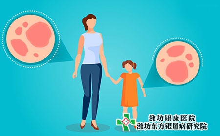 揚州銀屑病醫院治療牛皮癬哪所靠譜