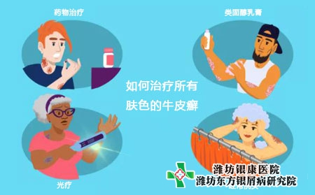 徐州那個醫院專業治療牛皮癬費用少