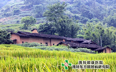 防治牛皮癬的方法有哪些? 防治牛皮癬的方法有哪些?