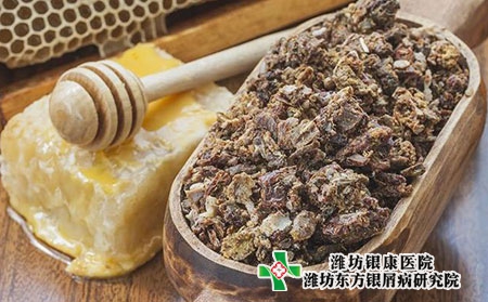 牛皮癬患者要忌口的食物有哪些?維生素D的作用?