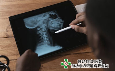 大腿小腿上有牛皮膚癬的癥狀圖片