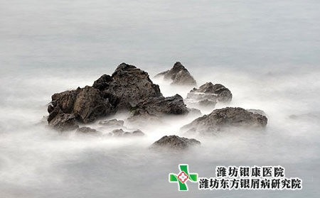 紅皮病型牛皮癬到底是什么?癥狀表現(xiàn)是什么?