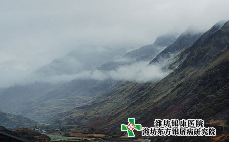 各種牛皮膚癬早期癥狀圖片