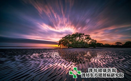 2022濰坊寒亭區治療銀屑病的醫院哪家好