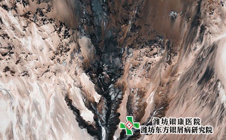 濰坊市坊子區銀屑病醫院在哪