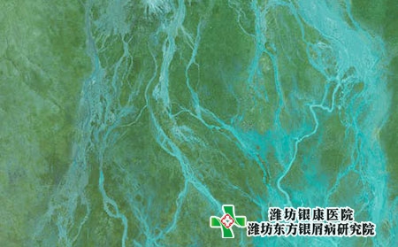 濰坊昌樂治療牛皮癬哪家醫院好