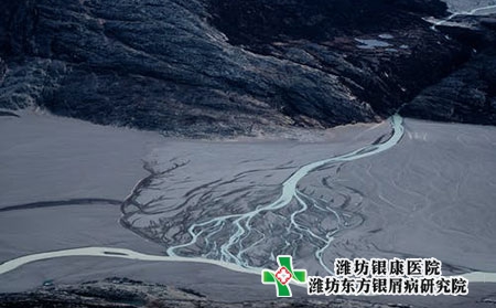 濰坊高新區(qū)得了牛皮癬找哪家醫(yī)院 濰坊高新區(qū)得了牛皮癬找哪家醫(yī)院