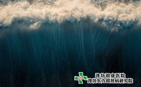 嬰兒牛皮膚癬圖片頭上頭癥狀圖片