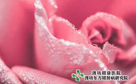 手掌血熱性牛皮膚癬的癥狀圖片