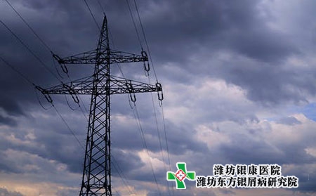 手指牛皮膚癬的癥狀圖片副牛皮膚癬癥狀圖片