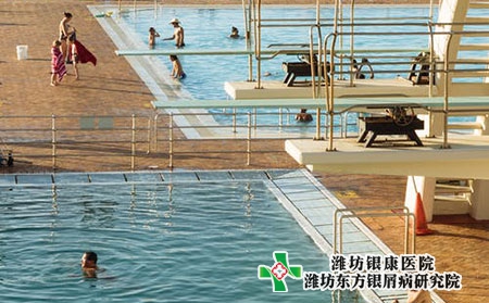 銀屑病的初期四個癥狀表現(xiàn)是什么?