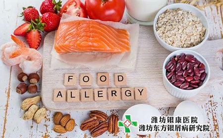 牛皮癬患者可以吃魚油和海鮮嗎?如何合理飲食? 牛皮癬患者可以吃魚油和海鮮嗎?如何合理飲食?