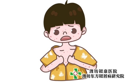 全國治療銀屑病的醫院哪一家專業