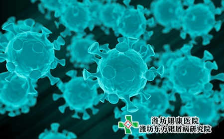 東營治療牛皮癬的醫院能花多少錢