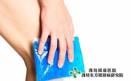 銀屑病是怎么形成的?關節型的特點有哪些?