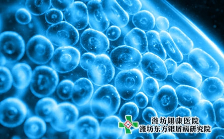 萊蕪銀屑病治療好的醫院是哪家