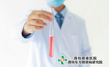 青島治療銀屑病的醫院應該有幾家正規專業的