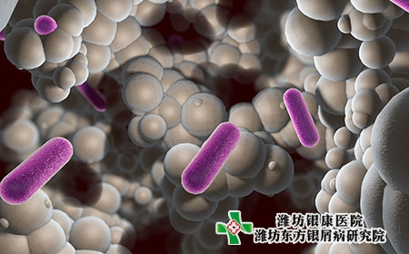 銀屑病為什么會(huì)反復(fù)發(fā)作?防治措施有哪些?