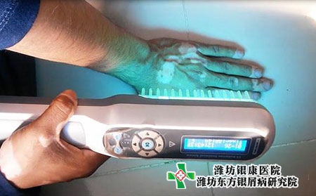 泰安治療牛皮癬的醫院疫情期間還開門嗎