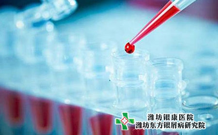 牛皮膚癬的那些癥狀表示快要臨床治愈了?