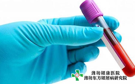 牛皮膚癬到底是怎么引起的?應(yīng)該如何防治?