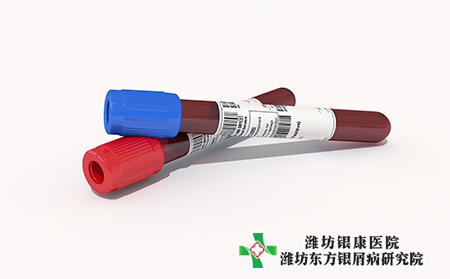 濰坊高密治療銀屑病的醫院哪一家好 濰坊高密治療銀屑病的醫院哪一家好