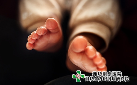 濰坊高密治療銀屑病的價格貴嗎