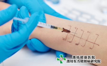 生物制劑治牛皮膚癬的效果怎么樣 生物制劑治牛皮膚癬的效果怎么樣