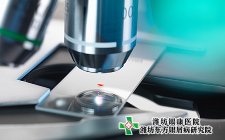 濰坊安丘牛皮癬患者治療去哪家醫院好