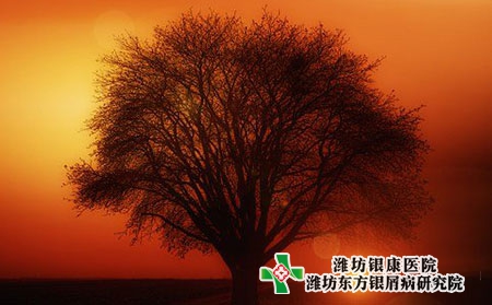 濰坊諸城牛皮癬醫(yī)院應(yīng)該怎么治