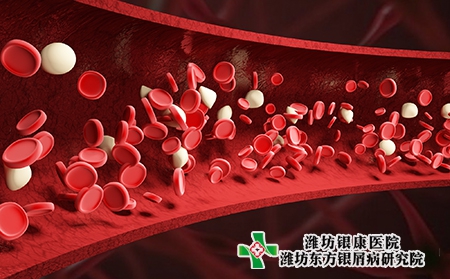 東營銀屑病醫院治療銀屑病好的