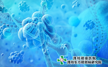 萊蕪銀屑病醫(yī)院選擇好醫(yī)院很重要