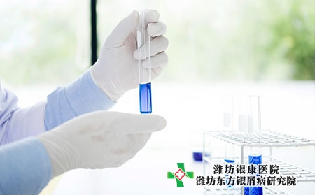 銀屑病的一些常見的誤區是什么? 銀屑病的一些常見的誤區是什么?