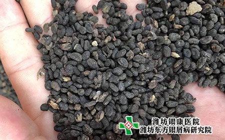 治療銀屑病的草藥圖片：補骨脂治銀屑病嗎?