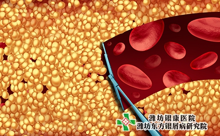 牛皮膚癬的誘發因素有哪些?