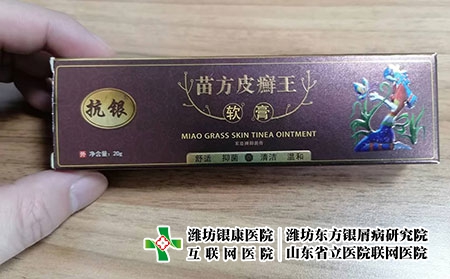 苗方皮癬王-皮癬王可以治療銀屑病