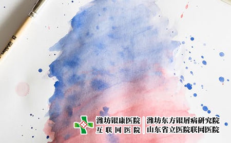 銀屑病治療多長時間能好