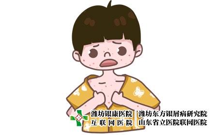 濰坊東方牛皮癬醫(yī)院：牛皮癬癥狀擴散是什么原因引起的
