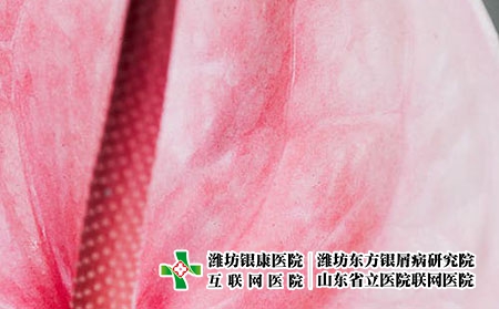 濰坊牛皮癬醫院醫治銀屑病那個費用合理