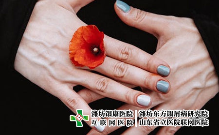 手部牛皮癬怎么根治