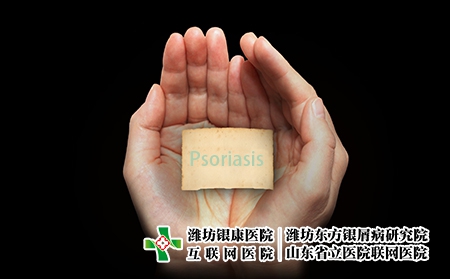 [濰坊銀屑病誠信東方]銀屑病早期怎么治