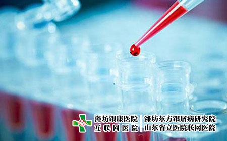 濰坊東方銀屑病醫院：牛皮癬跟什么因素有關?