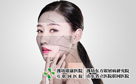 女性牛皮膚癬早期癥狀圖片