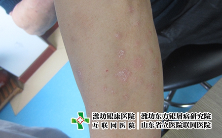 濰坊牛皮屑中醫上如何分類?牛皮屑有哪些種類?