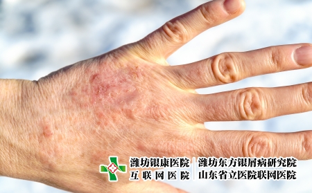 攝圖網(wǎng)_305177811_詳細(xì)縫合干成熟女手照護(hù)和皮膚病癥概念詳細(xì)縫合干成熟女手（企業(yè)商用）