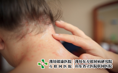 攝圖網_506517894_女用止痛藥膏使頸部皮膚（企業商用）