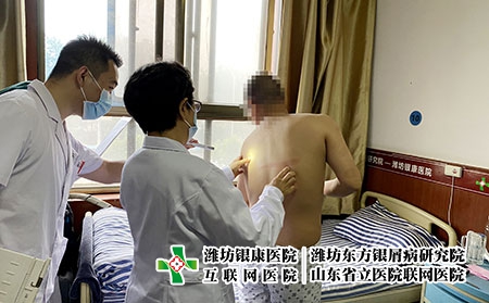 濰坊治療銀屑病管不管-濰坊銀屑病光療中心-濰坊銀屑病研究院的評價怎么樣啊 濰坊治療銀屑病管不管-濰坊銀屑病光療中心-濰坊銀屑病研究院的評價怎么樣啊