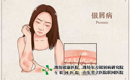 攝圖網(wǎng)_401804080_銀屑病醫(yī)療插畫（企業(yè)商用）
